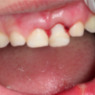 Urgencias dentales en Mataró