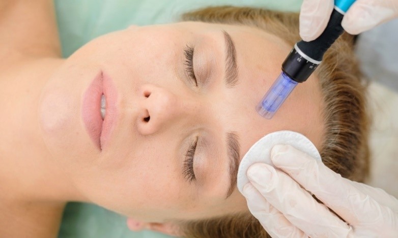 Microneedling course