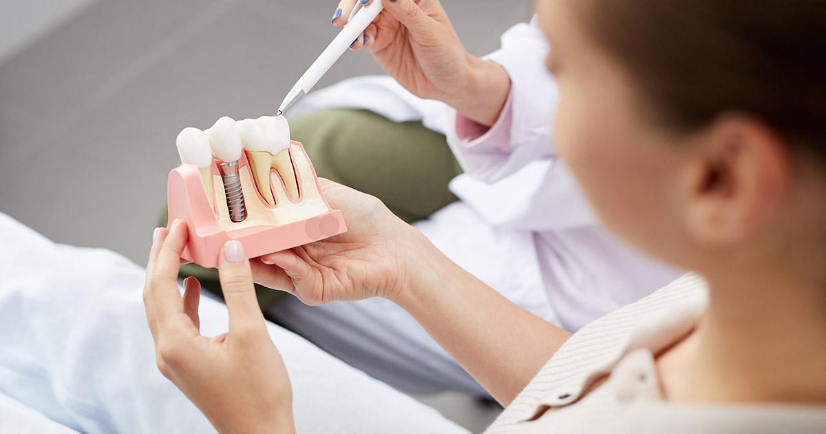mantenimiento implantes dentales aluche