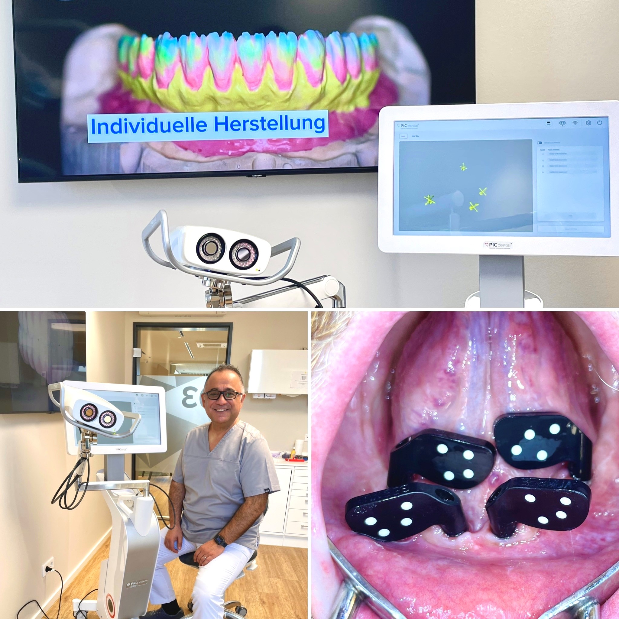 Feste Zähne an einem Tag Moers Duisburg
