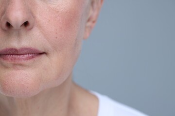 2 Arten von Fadenlifting, Mono-und Zugfäden